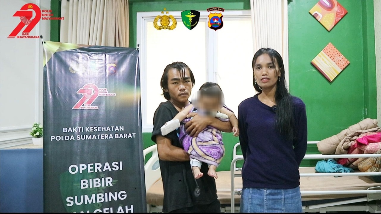 Rumah Sakit Bhayangkara Polda Sumbar Gelar Bakti Sosial Operasi Bibir Sumbing Gratis dalam Rangka HUT Bhayangkara ke-79